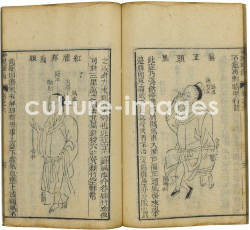 Fu Renyu, Shen Shi Yao Han (Ein preziöses Buch der Augenheilkunde)