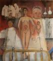 Frida Kahlo, Frida und der Kaiserschnitt oder Das Krankenhaus
